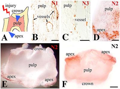 Monitoring Notch Signaling-Associated Activation of Stem Cell Niches within Injured Dental Pulp